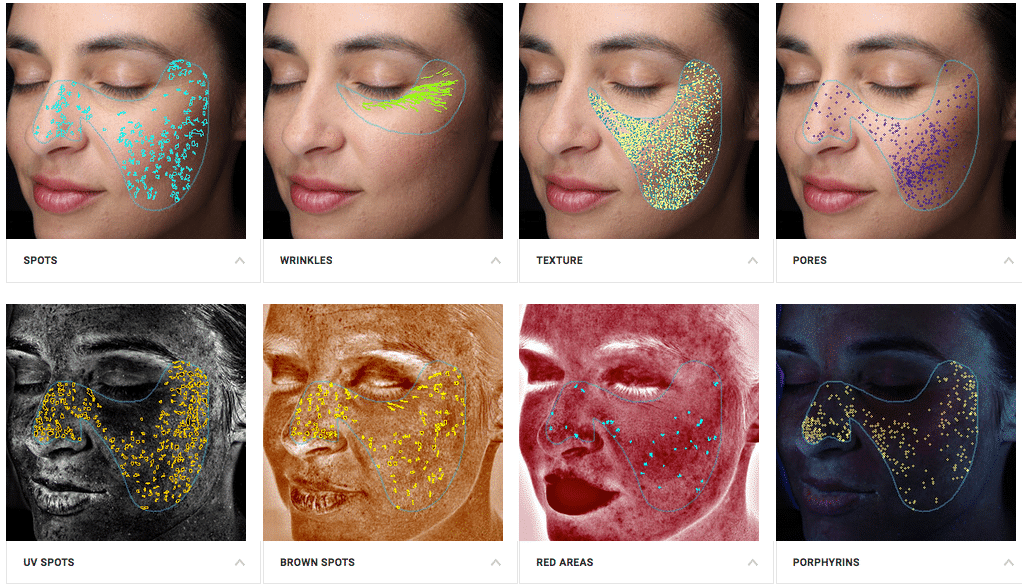 iiaa Skin Visia Consultation images - Spots, Wrinkles, Texture, Pores, UV Spots, Brown Spots, Red Areas, Porphyrins